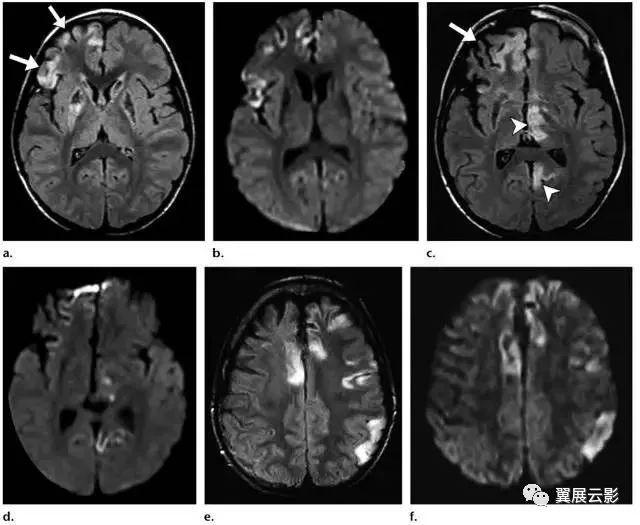 金光佛4949免费资料,多元化诊断解决_UTJ55.656影像处理版