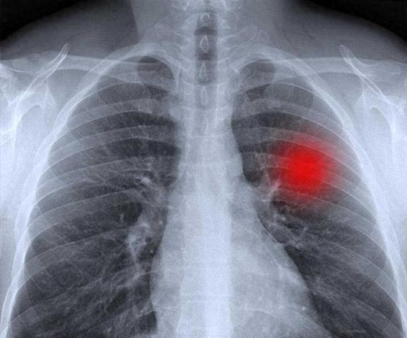 戴建武手术最新进展，时代进步与医学飞跃的体现