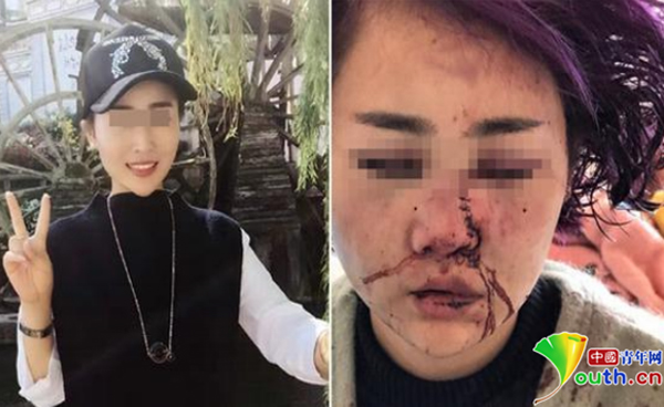 丽江女游客被毁容最新消息,数据获取方案_美学版23.137